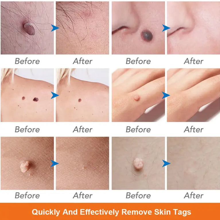 Beauty Pen Magic Pen