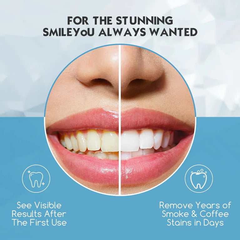 Dent Up - Professional Teeth Whitening