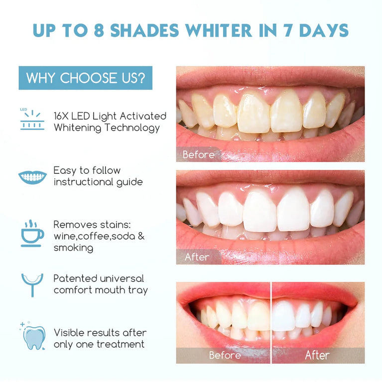 Dent Up - Professional Teeth Whitening
