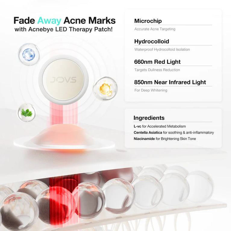 JOVS Acnebye - Acne and Blemish Remover