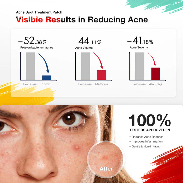 JOVS Acnebye - Acne and Blemish Remover
