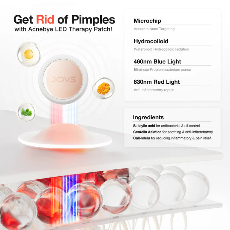JOVS Acnebye - Acne and Blemish Remover