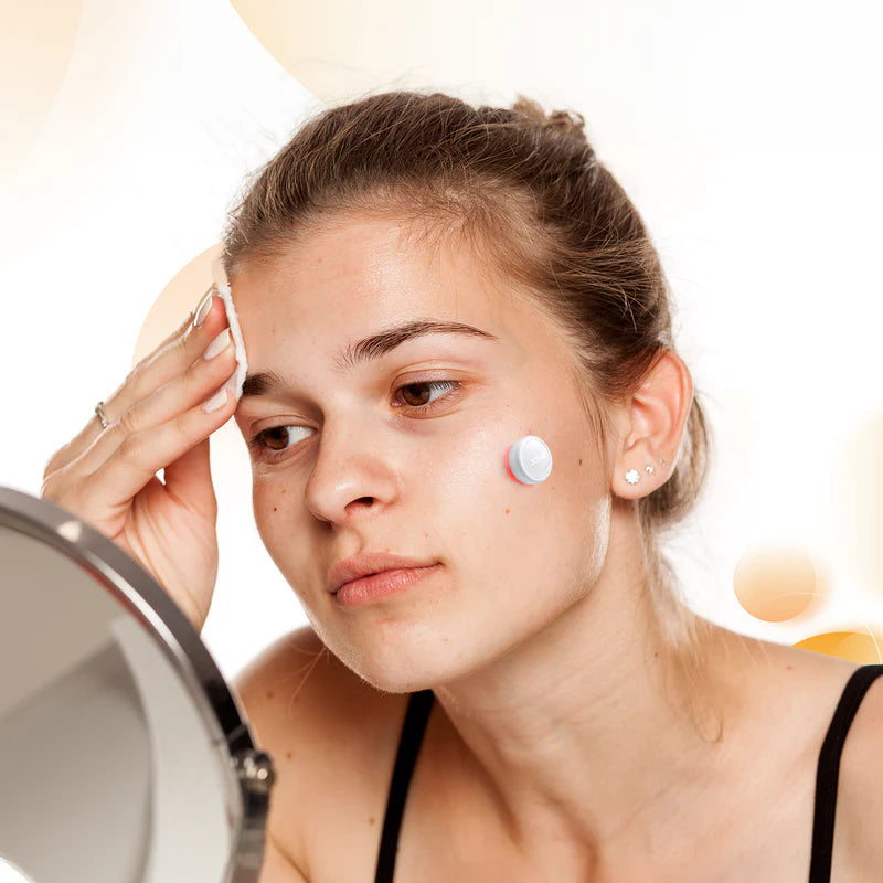 JOVS Acnebye - Acne and Blemish Remover