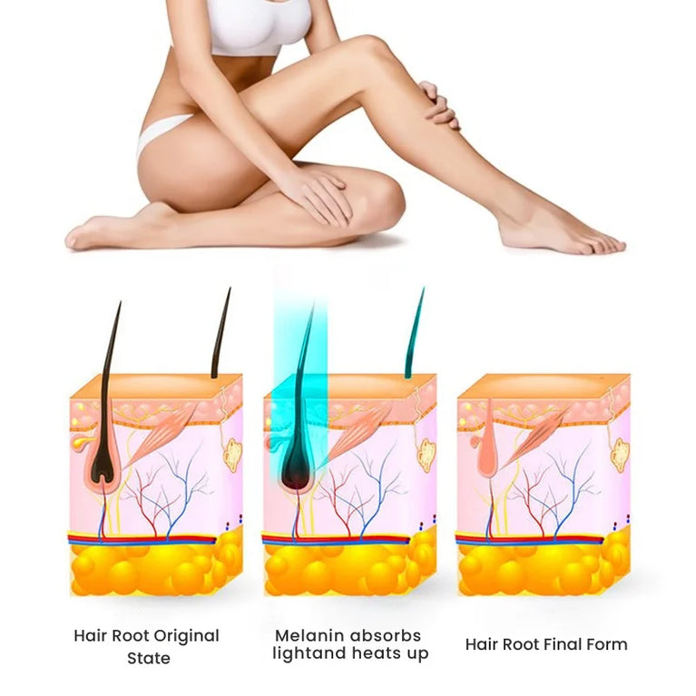 NoTime OPT Professional Ice Laser Hair Removal