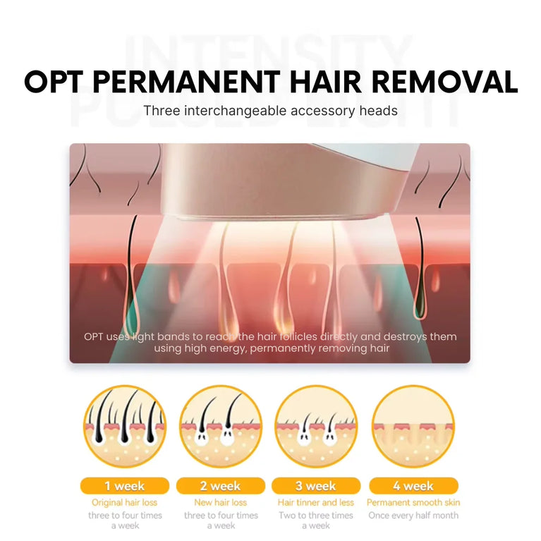 NoTime OPT Professional Ice Laser Hair Removal