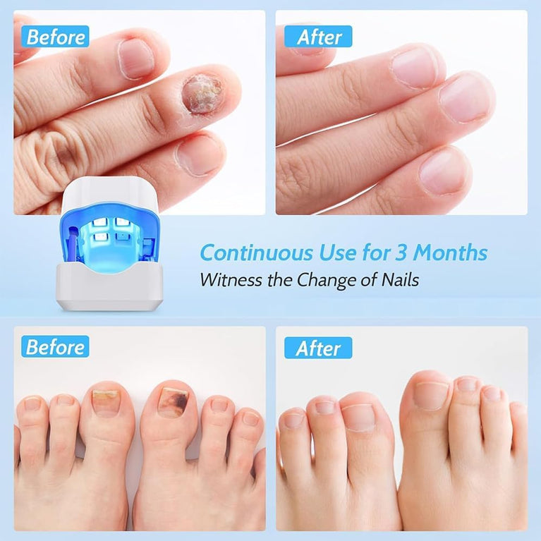 TOE+ Great Fingers
